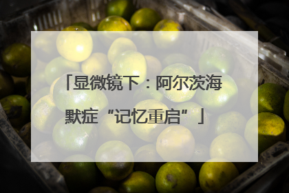 显微镜下：阿尔茨海默症“记忆重启”
